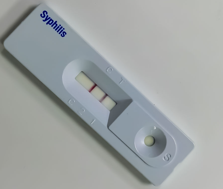 Strip Cepet Syphilis Antigen Rapid